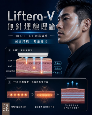 Liftera-V面部緊緻提升療程-體驗價 Liftera-V面部緊緻提升療程-體驗價